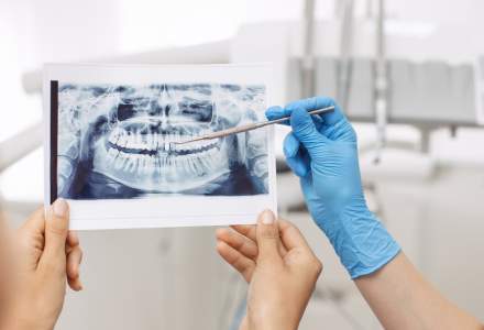 Implantodent, clinica stomatologica care ofera speranta celor "condamnati" sa traiasca fara dinti