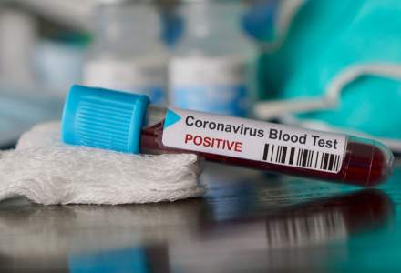 România a depășit pragul de 4.000 de infecții cu noul coronavirus