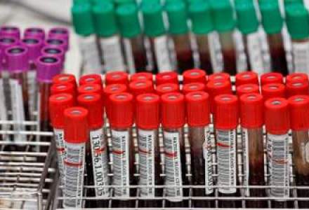 De ce pretuiesc asiguratorii de viata analizele de sange