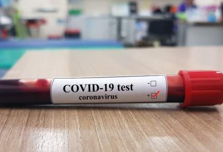 Nelu Tătaru: Câte testări pentru COVID-19 au fost făcute în România de la începutul pandemiei