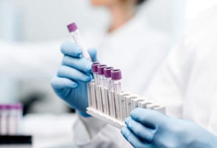 Teste Real Time PCR pentru diagnosticarea COVID-19, disponibile la cerere în 25 de orașe din țară din rețeaua Synevo