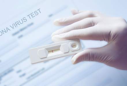 SUA au aprobat distribuirea unui test rapid de utilizare individuală