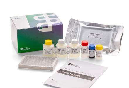 A fost lansat primul kit ELISA pentru detecția anticorpilor SARS-CoV-2 IgG, dezvoltat integral în România