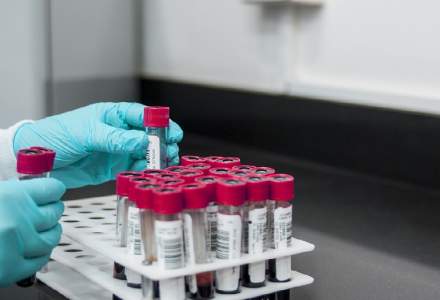 Agenţii sanitare europene:Este necesară efectuarea mai multor teste pentru detectarea timpurie a infecţiei HIV