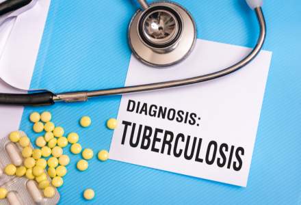 Tuberculoza rămâne o problemă: câți români au fost diagnosticați în 2020