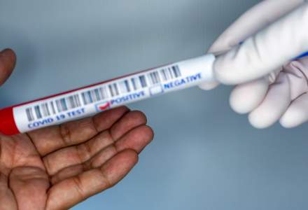 Românii vor putea face teste anti-COVID în farmacii
