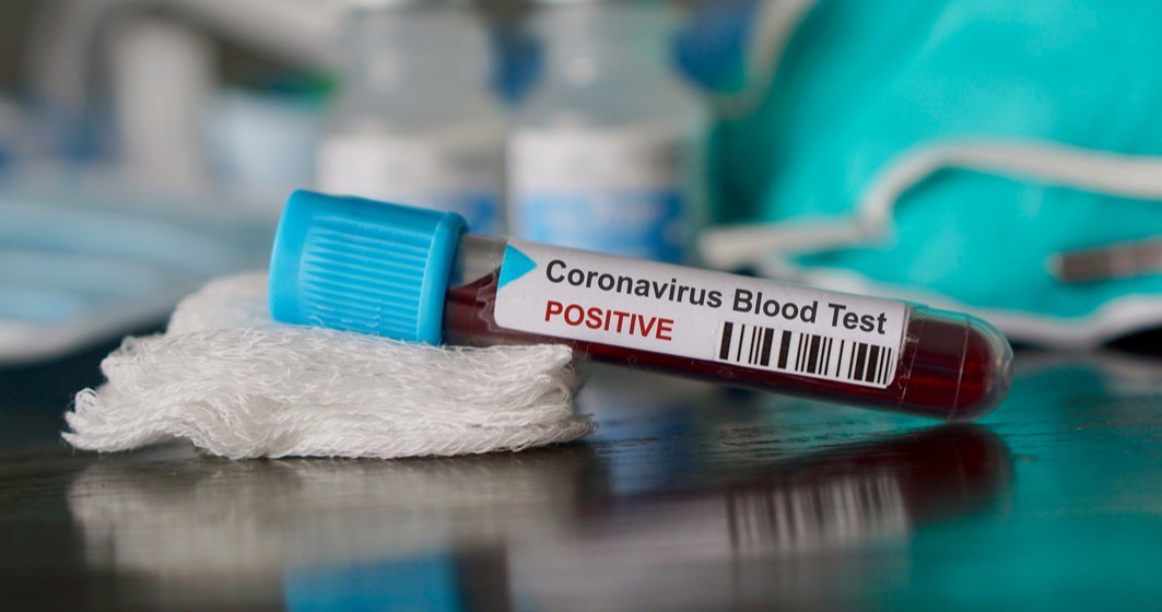Românul care întreba pe Facebook dacă a văzut cineva un mort de coronavirus a murit din cauza virusului