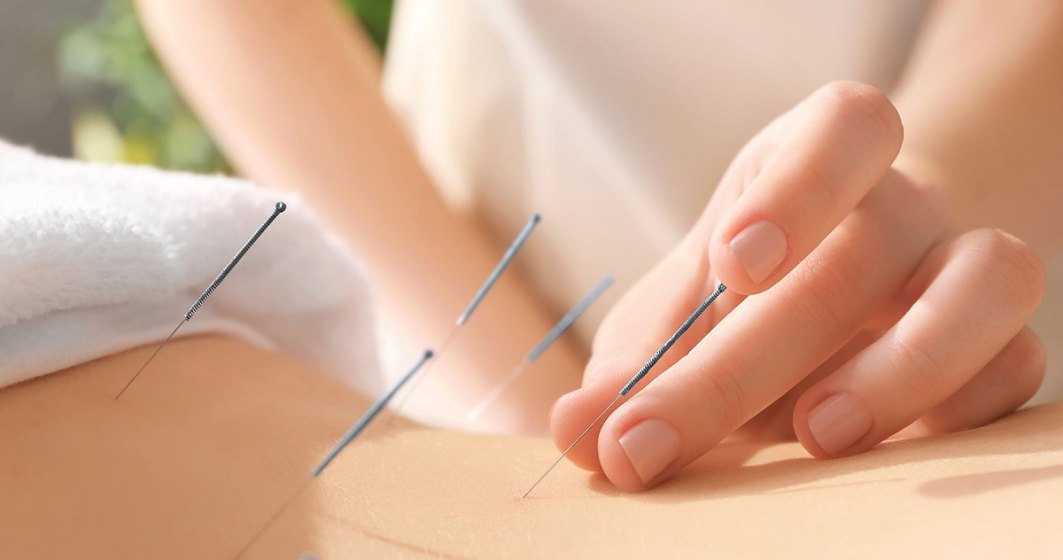 De ce este important un tratament acupunctură și ce ar trebui să știm despre această practică străveche ?