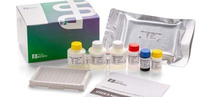 A fost lansat primul kit ELISA pentru detecția anticorpilor SARS-CoV-2 IgG,...