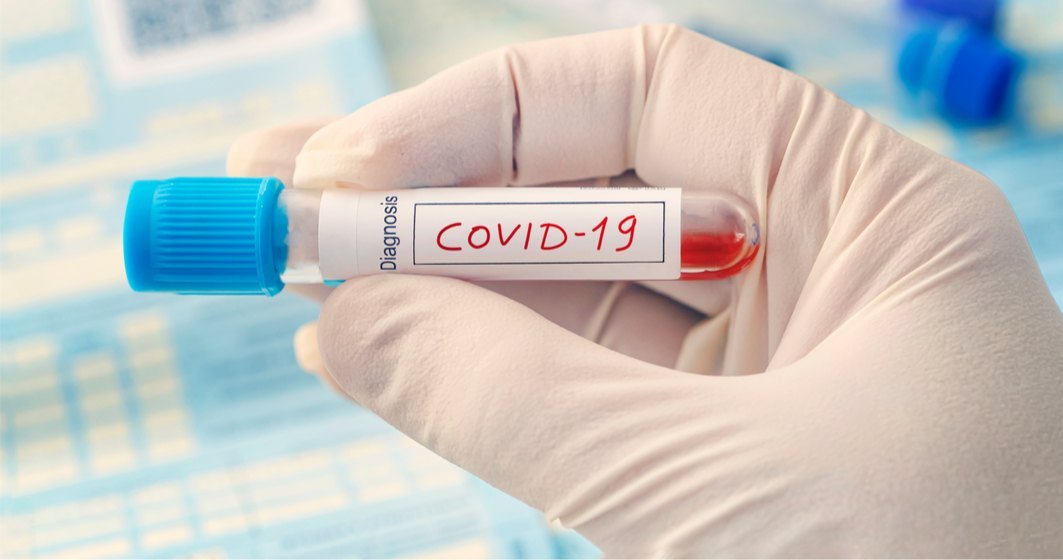 Spania impune prezentarea unui test COVID-19 negativ celor care provin din ”țări cu risc”