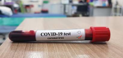 CORONAVIRUS | Un medic de la Matei Balș explică de nu se fac mai multe teste...