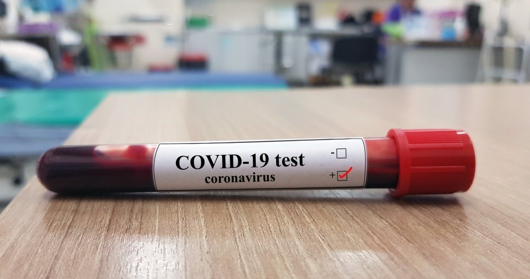 Nelu Tătaru: Câte testări pentru COVID-19 au fost făcute în România de la începutul pandemiei