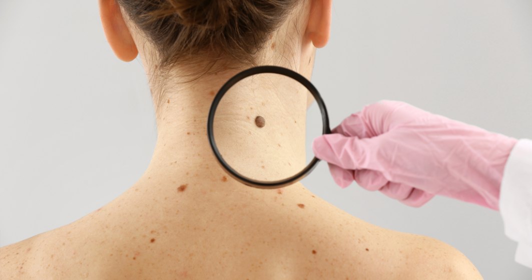 Afecțiunile dermatologice în care vaccinarea anti-COVID-19 este contraindicată