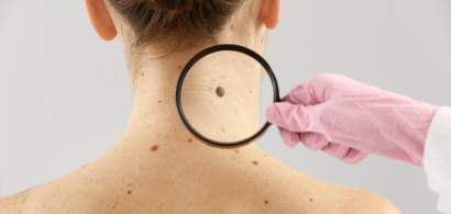 Afecțiunile dermatologice în care vaccinarea anti-COVID-19 este contraindicată