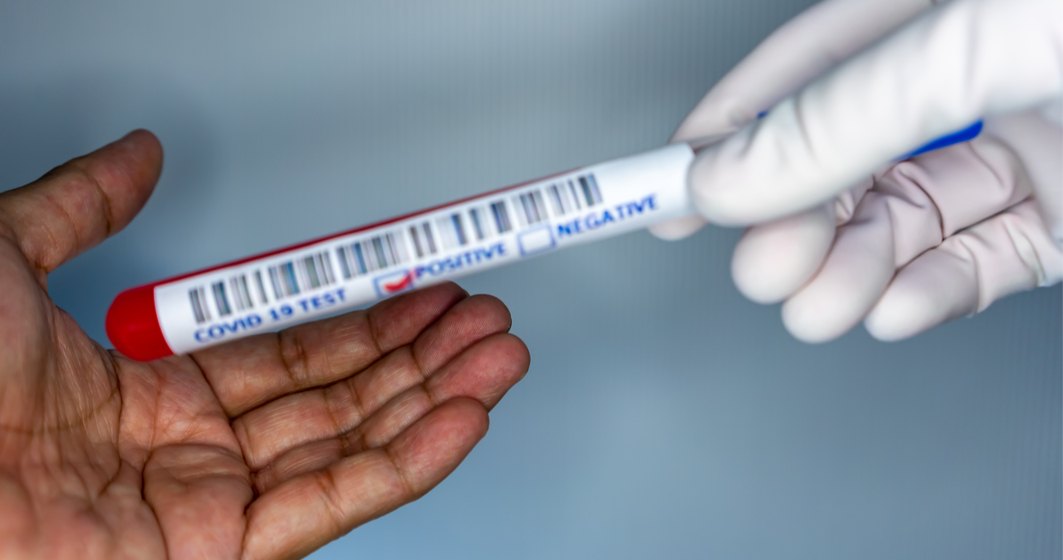 Vaccinul nu înseamnă sfârșitul pandemiei. Cum pot ajuta testele rapide