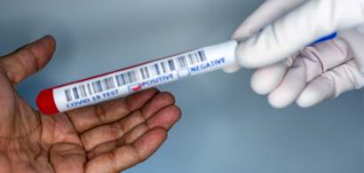 Vaccinul nu înseamnă sfârșitul pandemiei. Cum pot ajuta testele rapide
