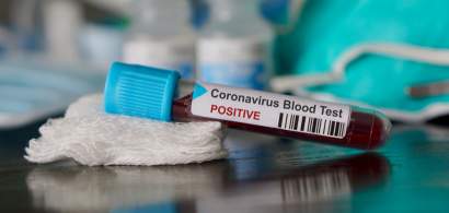 Coronavirus 7 mai | Scade numărul pacienților internați la ATI