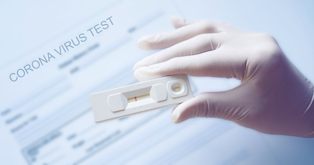 SUA au aprobat distribuirea unui test rapid de utilizare individuală