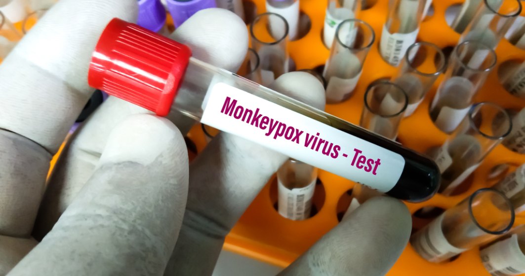 Focarele de variola maimuței dau startul cursei pentru producția de vaccin