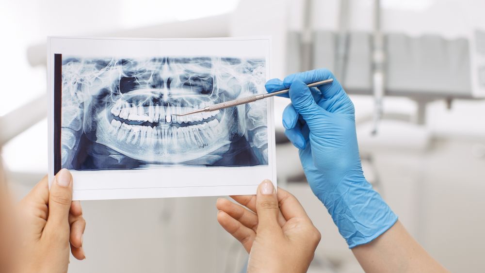 Implantodent, clinica stomatologica care ofera speranta celor "condamnati" sa traiasca fara dinti