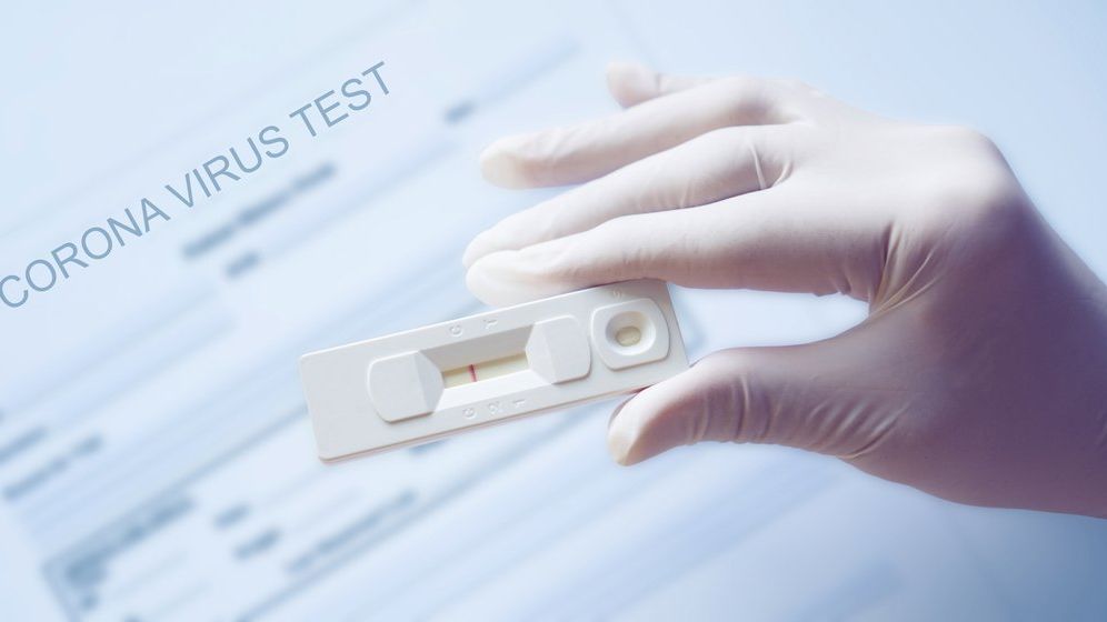 SUA au aprobat distribuirea unui test rapid de utilizare individuală