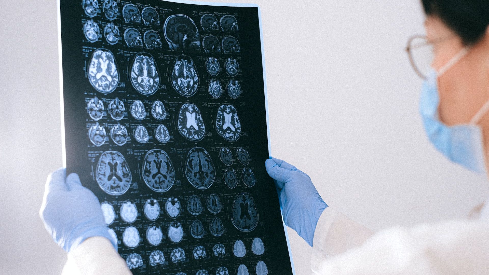 Cercetătorii australieni au descoperit un nou test de salivă, care va detecta anumite tipuri de cancer