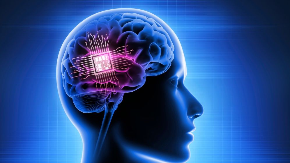 Musk promite că în 6 luni lansează implanturile conectate în creierul uman