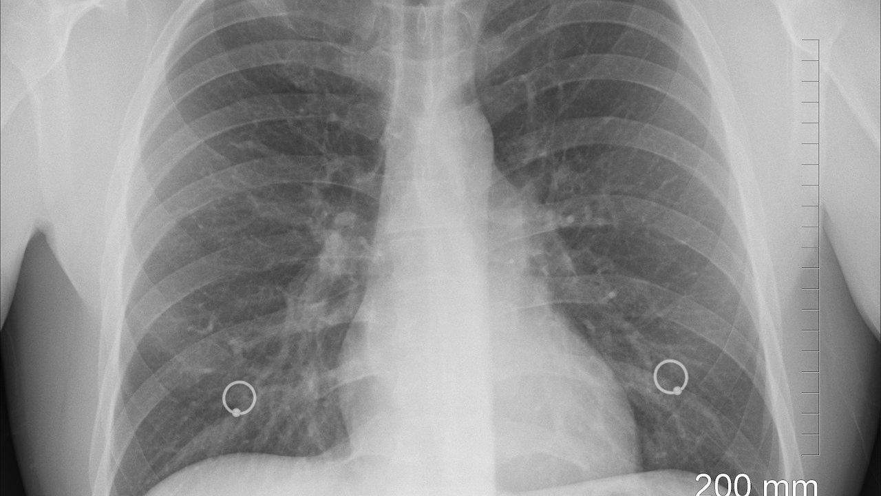 Start-up-ul românesc care ajută la interpretarea radiografiilor prin inteligența artificială se extinde în Europa