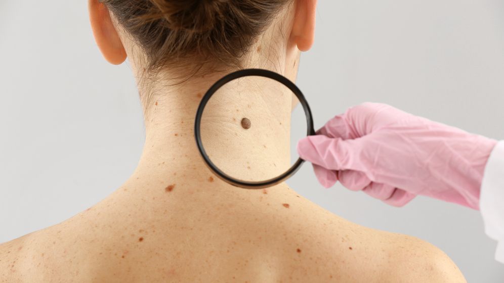 Afecțiunile dermatologice în care vaccinarea anti-COVID-19 este contraindicată