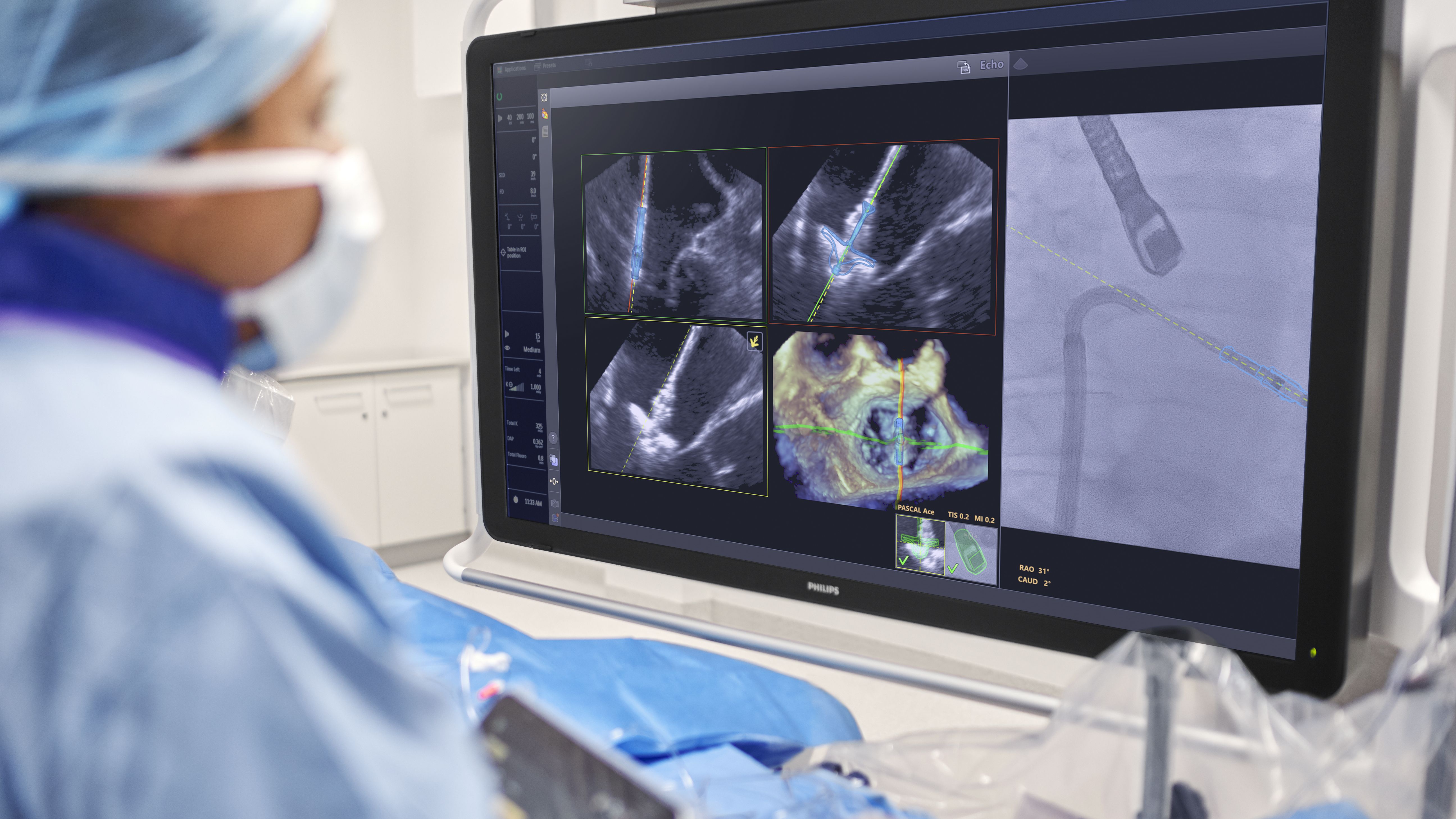 Anchetă a Concurenței pe piața echipamentelor medicale: investigație la Philips România și 10 distribuitori