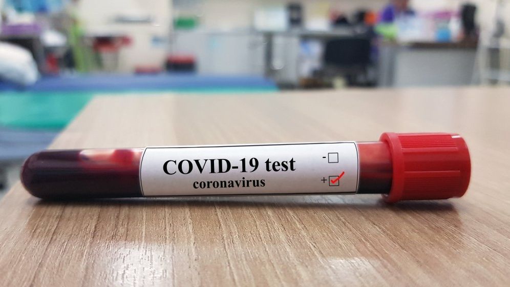 Nelu Tătaru: Câte testări pentru COVID-19 au fost făcute în România de la începutul pandemiei