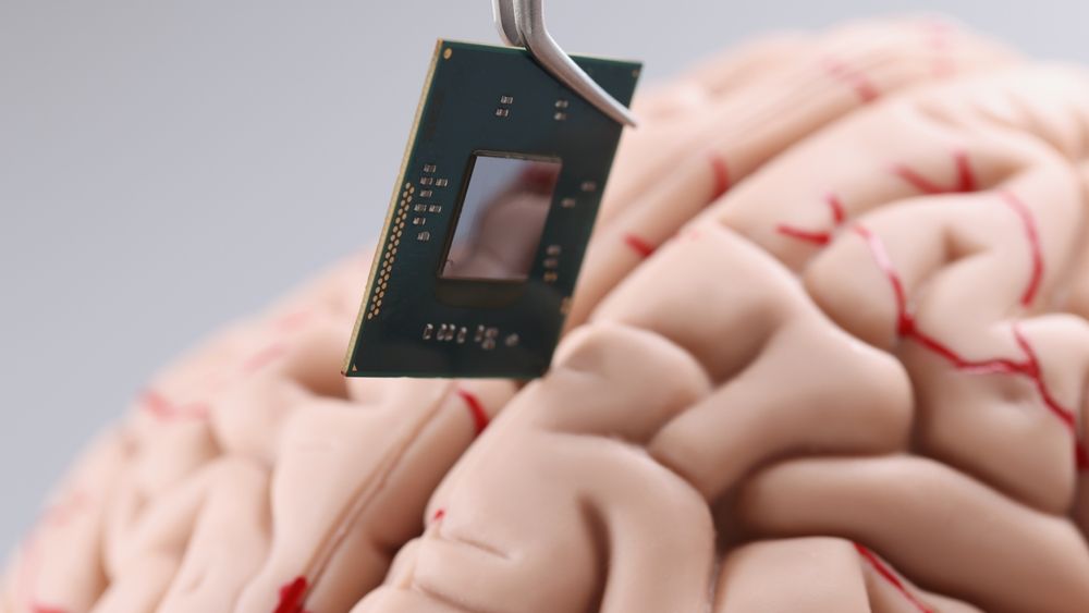 Chinezii, tot mai aproape să introducă implanturile cerebrale pentru oameni. Testele continuă