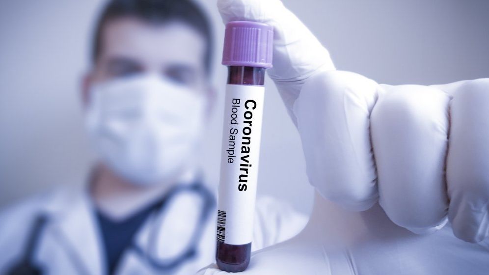 Avocatul Poporului consideră excesivă condiţionarea întoarcerii la muncă a salariatului de prezentarea unui test negativ SARS-CoV-2