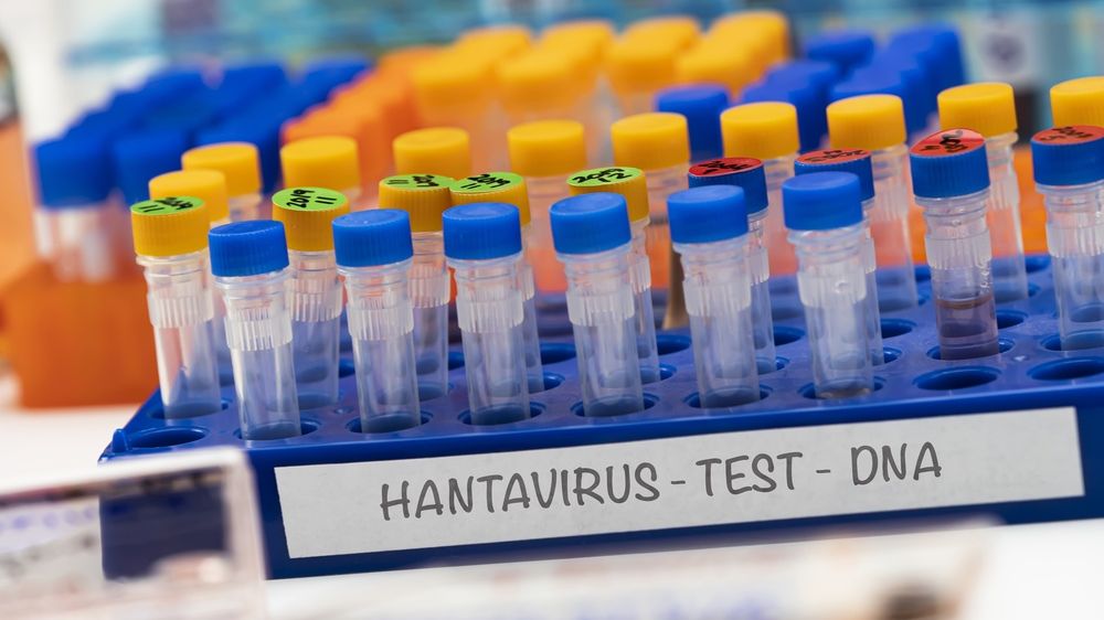 Un nou suspect de hantavirus este investigat de&nbsp;DSP Caraş-Severin