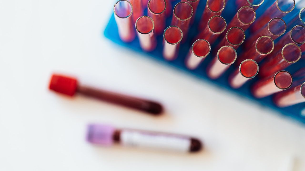 Piața studiilor clinice din România, estimată la 72 mil euro, ar putea crește de cel puțin 10 ori. Domenii cheie pentru dezvoltare