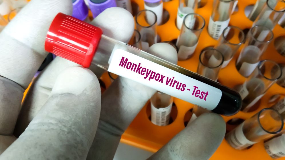 Focarele de variola maimuței dau startul cursei pentru producția de vaccin