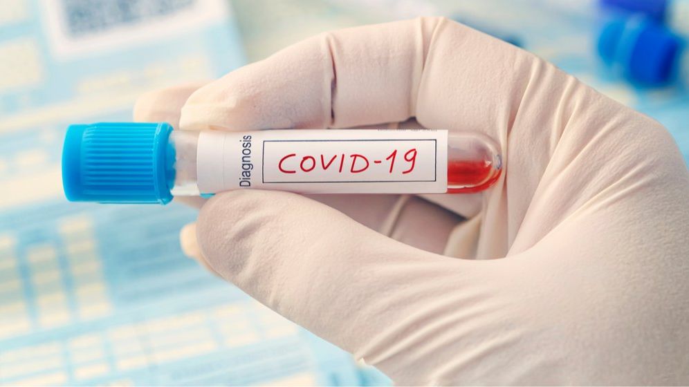 O nouă variantă a SARS-CoV-2 a fost detectată: ce spun specialiștii