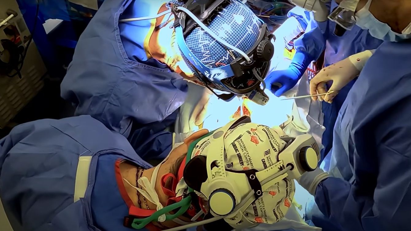 Premieră mondială: Transplant cu succes a unei inimi de porc la un bărbat de 57 de ani