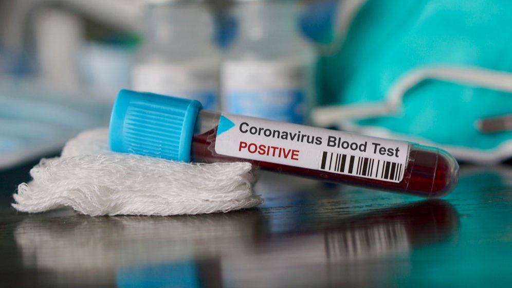 Ce se întâmplă cu testarea bucureștenilor pentru COVID-19