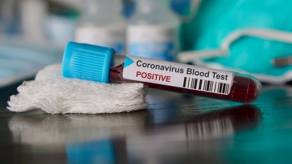 Coronavirus 16 septembrie | Care sunt județele care au intrat în scenariul galben