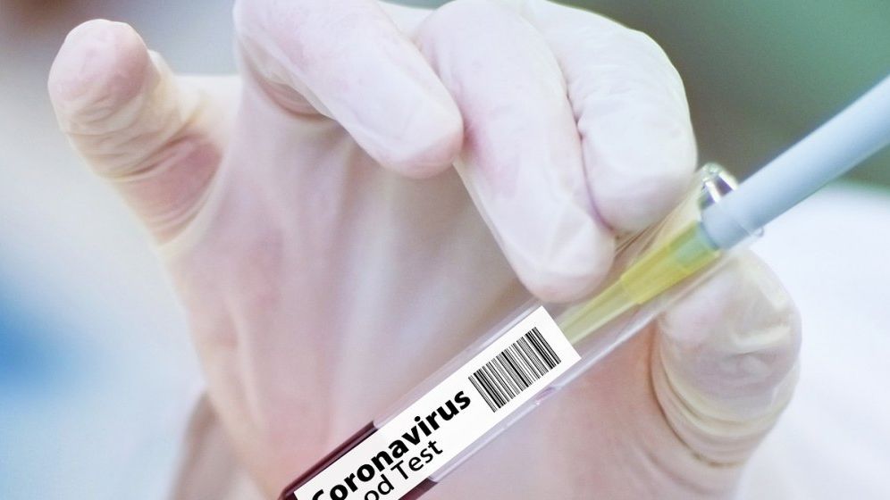 Johnson & Johnson va începe din iulie testarea pe oameni a vaccinului anti Covid-19