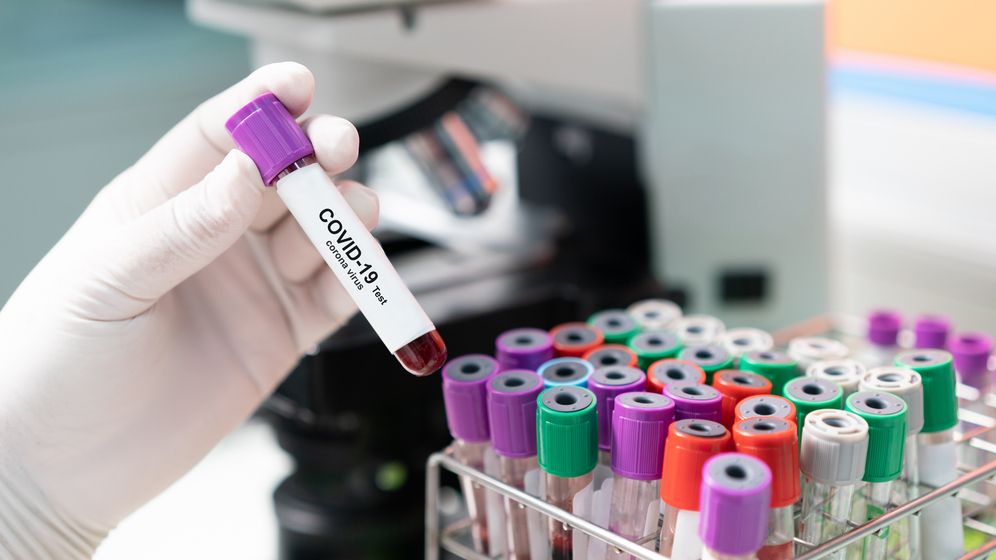 COVID 31 ianuarie | Peste 20.000 de cazuri după o zi de duminică