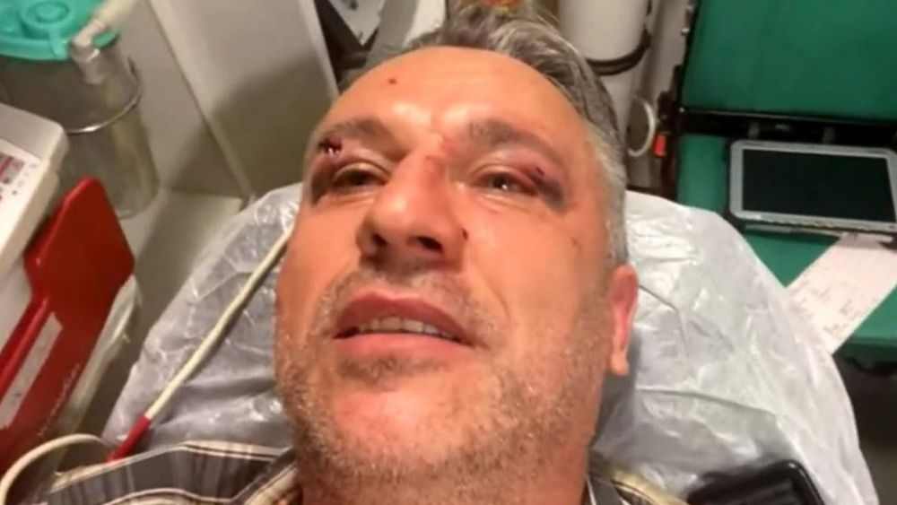 S-au găsit vinovații în cazul agresării jurnaliștilor și a activistului de mediu. Poliția a reținut mai multe persoane
