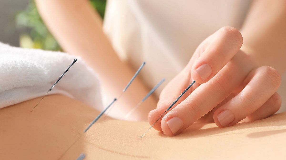 De ce este important un tratament acupunctură și ce ar trebui să știm despre această practică străveche ?