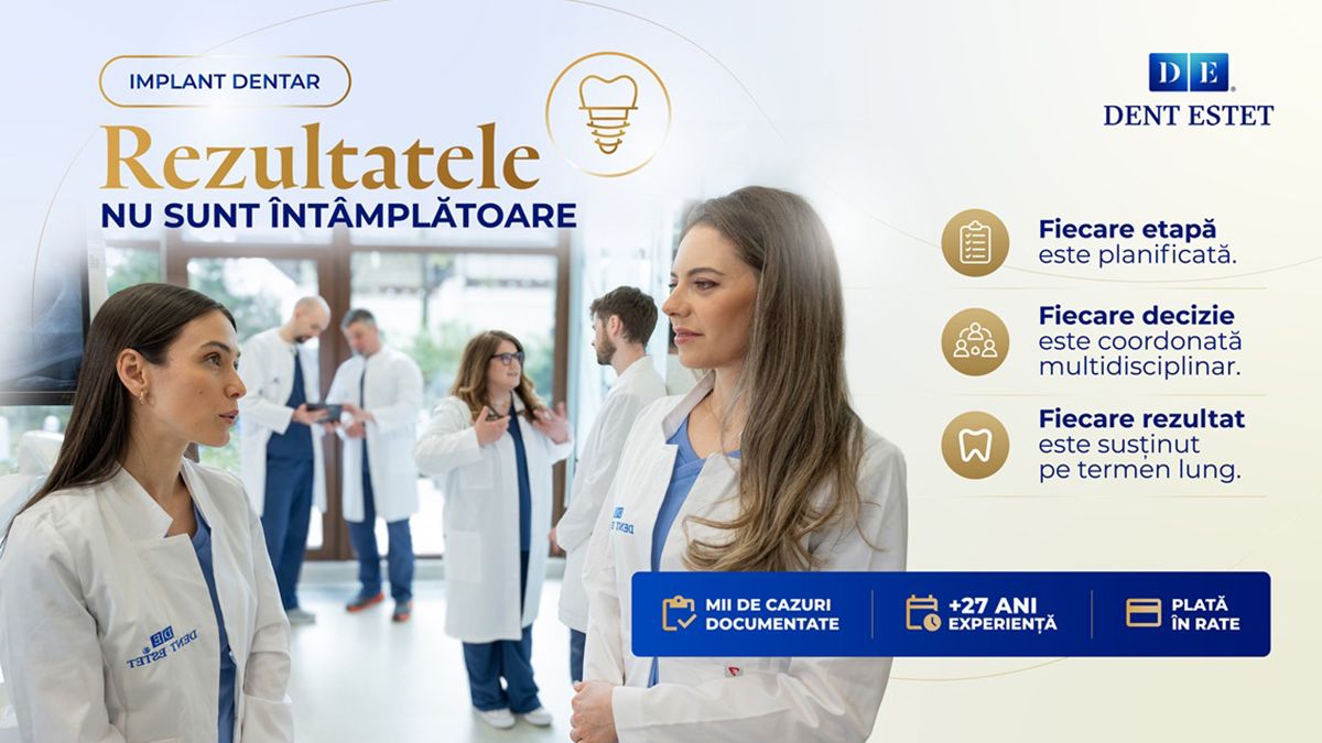 Cum sa alegi un implant dentar sigur si eficient in Bucuresti