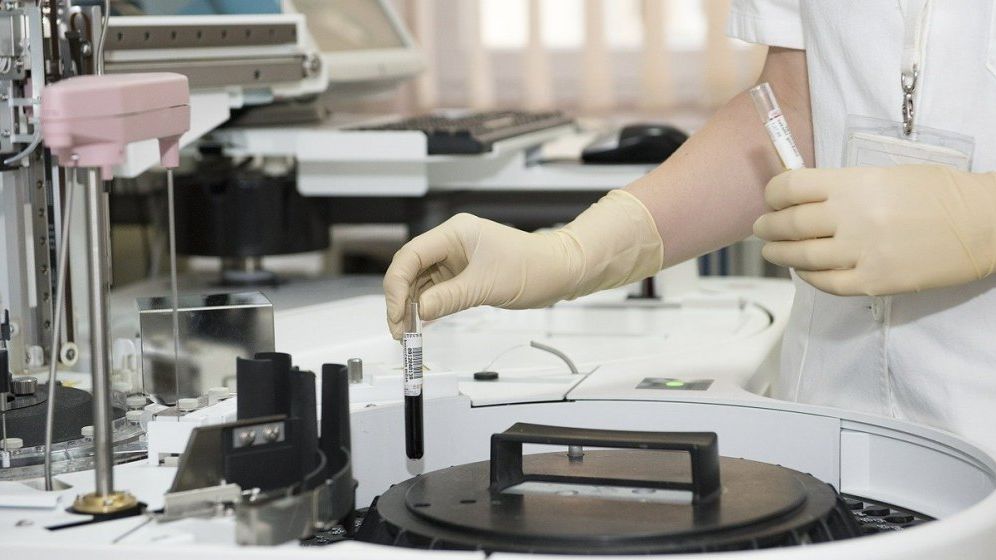 China a depistat urme de coronavirus într-un lot de aripioare de pui congelate provenite din Brazilia