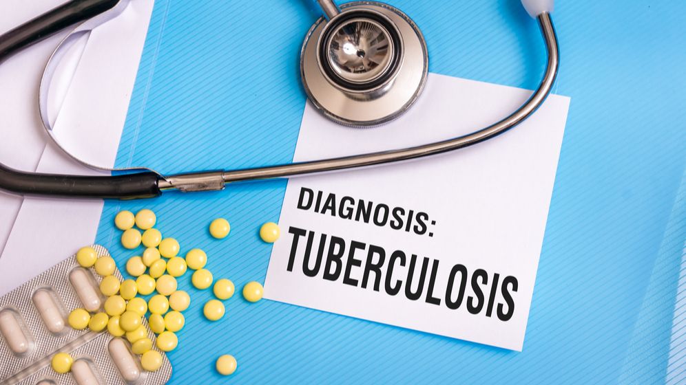 Tuberculoza rămâne o problemă: câți români au fost diagnosticați în 2020