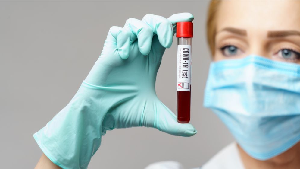 UPDATE Coronavirus 21 octombrie | RECORD ABSOLUT de infectări