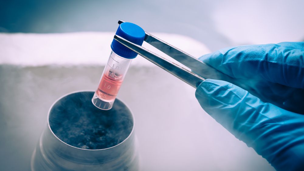 Romania se afla pe ultimele locuri in UE la transplantul de celule stem