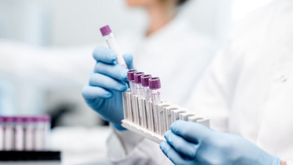 Laboratoarele private sar în ajutorul statului. Synevo ar putea prelucra teste pentru depistarea noului coronavirus, sub atenta supraveghere a autorităților